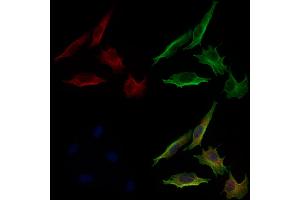 ABIN6264566 and ABIN6279733 staining 3 by IF/ICC. (RAB24 Antikörper  (Internal Region))