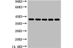 Western blot analysis of 1) 293T, 2) Hela, 3) HepG2, 4) Mouse Brain tissue, (EIF4A1 Antikörper)