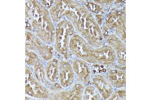 Immunohistochemistry (IHC) image for anti-Dihydrolipoyl Transacetylase (DLAT) (AA 87-270) antibody (ABIN7266768)