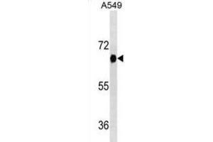 Western Blotting (WB) image for anti-Dual-Specificity tyrosine-(Y)-phosphorylation Regulated Kinase 2 (DYRK2) antibody (ABIN2995437) (DYRK2 Antikörper)