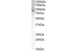 Image no. 1 for anti-phosphodiesterase 4B, cAMP-Specific (PDE4B) (C-Term) antibody (ABIN374649) (PDE4B Antikörper  (C-Term))