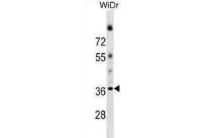 Western Blotting (WB) image for anti-Asparagine-Linked Glycosylation 5, Dolichyl-Phosphate beta-Glucosyltransferase Homolog (S. Cerevisiae) (ALG5) antibody (ABIN2999771)