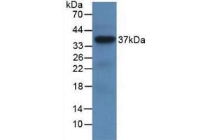 Western blot analysis of recombinant Human LRG1. (LRG1 Antikörper  (AA 37-340))