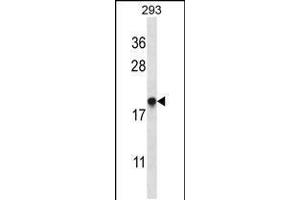 Western blot analysis in 293 cell line lysates (35ug/lane). (EMC4 Antikörper  (N-Term))