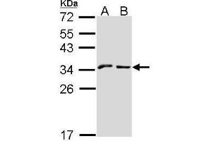 WB Image Sample (30 ug of whole cell lysate) A: A431 , B: Hep G2 , 12% SDS PAGE NKG2-A (CD159a) antibody antibody diluted at 1:1000