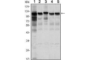 Western blot analysis using HK1 mouse mAb against Jurkat (1), Hela (2), HepG2 (3), MCF-7 (4) and PC-12 (5) cell lysate. (Hexokinase 1 Antikörper)