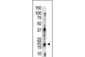 Antibody is used in Western blot to detect UBE2G2 in Jurkat cell lysate. (UBE2G2 Antikörper  (N-Term))