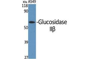 Western Blot (WB) analysis of specific cells using Glucosidase IIbeta Polyclonal Antibody.