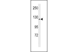 Western blot analysis of VGFR1 Antibody (ABIN653260 and ABIN2842780) in MCF-7 cell line lysates (35 μg/lane). (FLT1 Antikörper)