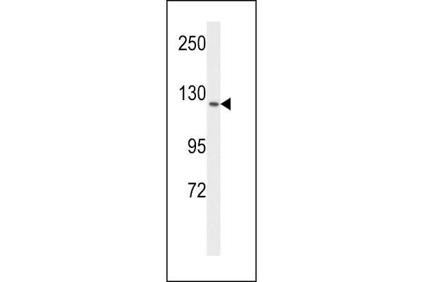 FLT1 Antikörper