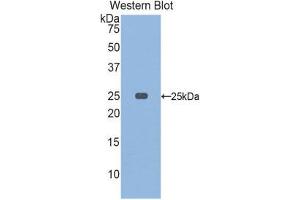Western Blotting (WB) image for anti-Osteoclast Stimulating Factor 1 (OSTF1) (AA 10-215) antibody (ABIN1860107) (OSTF1 Antikörper  (AA 10-215))