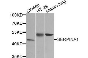 Western blot analysis of extracts of various cell lines, using SERPINA1 antibody. (SERPINA1 Antikörper  (AA 25-315))