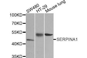 Western blot analysis of extracts of various cell lines, using SERPINA1 antibody.