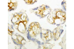 Anti-P cadherin antibody, IHC(P) IHC(P): Human Placenta Tissue