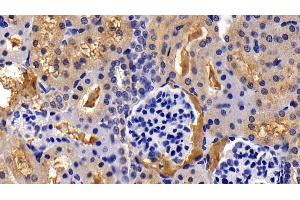 Immunohistochemistry (IHC) image for anti-Immunoglobulin Superfamily Containing Leucine Rich Repeat Protein (ISLR) (AA 19-428) antibody (ABIN7441502)