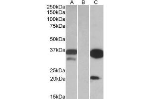 HEK293 lysate (10ug protein in RIPA buffer) over expressing Human DAPP1 with DYKDDDDK tag probed with ABIN768627 (0. (DAPP1 Antikörper  (Internal Region))
