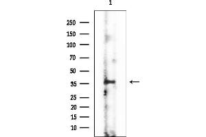 Western blot analysis of lysates from Rat muscle, using FAS Mouse Monoclonal Antibody at 1/1000 dilution.