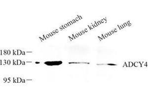 Western blot analysis of ADCY4 (ABIN7072959) at dilution of 1: 250