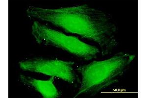 Immunofluorescence of purified MaxPab antibody to TUSC4 on HeLa cell. (NPRL2 Antikörper  (AA 1-380))