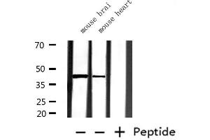 Western Blotting (WB) image for anti-Glutamate-Ammonia Ligase (GLUL) (C-Term) antibody (ABIN6261999)