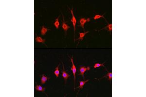 Immunofluorescence analysis of BALB-3T3 cells using Heparanase 1 Rabbit pAb (ABIN6128033, ABIN6141977, ABIN6141978 and ABIN6221391) at dilution of 1:100 (40x lens). (HPSE Antikörper  (AA 36-275))