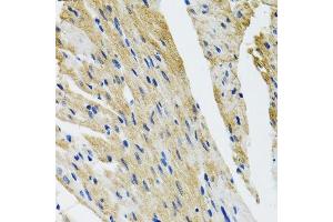 Immunohistochemistry of paraffin-embedded mouse heart using COPB2 antibody. (COPB2 Antikörper  (AA 657-906))