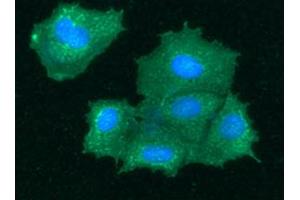 ICC/IF analysis of BHMT in Hep3B cells line, stained with DAPI (Blue) for nucleus staining and monoclonal anti-human BHMT antibody (1:100) with goat anti-mouse IgG-Alexa fluor 488 conjugate (Green). (BHMT Antikörper)