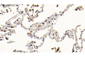 Detection of PGLYRP1 in Human Lung Tissue using Polyclonal Antibody to Peptidoglycan Recognition Protein 1 (PGLYRP1) (PGLYRP1 Antikörper  (AA 22-196))