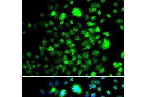 Immunofluorescence analysis of A549 cells using PEX14 Polyclonal Antibody (PEX14 Antikörper)