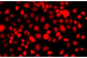 Immunofluorescence analysis of A549 cells using NR2E1 Polyclonal Antibody (NR2E1 Antikörper)