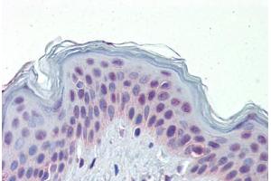 Immunohistochemistry (Paraffin-embedded Sections) (IHC (p)) image for anti-Nuclear Receptor Subfamily 2, Group C, Member 1 (NR2C1) (N-Term) antibody (ABIN6741570)