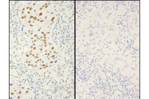 Immunohistochemistry (IHC) image for anti-X-Ray Repair Complementing Defective Repair in Chinese Hamster Cells 1 (XRCC1) (pSer518), (pThr519), (pThr523) antibody (ABIN7449037)