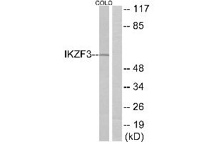 Western blot analysis of extracts from COLO cells, using IKZF3 antibody. (IKZF3 Antikörper)