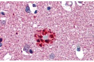 Immunohistochemistry (IHC) image for anti-Transcription Factor 21 (TCF21) (N-Term) antibody (ABIN2777930)