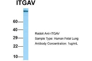 Host: Rabbit  Target Name: ITGAV  Sample Tissue: Human Fetal Lung  Antibody Dilution: 1. (CD51 Antikörper  (C-Term))