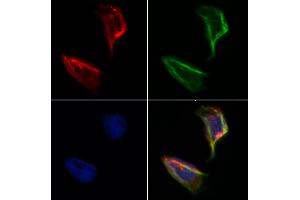 ABIN6264958 and ABIN6273159 staining Hela by IF/ICC. (SEC24A Antikörper  (Internal Region))