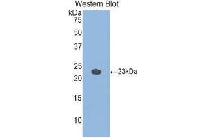 Western Blotting (WB) image for anti-Glucosidase, Alpha, Acid (GAA) (AA 755-953) antibody (ABIN1858938) (GAA Antikörper  (AA 755-953))