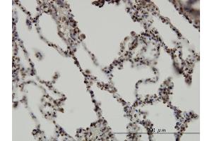 Immunoperoxidase of monoclonal antibody to RBM5 on formalin-fixed paraffin-embedded human lung. (RBM5 Antikörper  (AA 75-184))