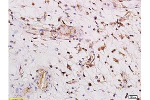 Formalin-fixed and paraffin embedded human enterocolitis labeled with Anti PARG1/Rho GTPase activating protein 29 Polyclonal Antibody, Unconjugated (ABIN762401) followed by conjugation to the secondary antibody and DAB staining (PARG1 Antikörper  (AA 301-400))