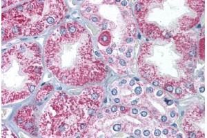 Human Kidney (formalin-fixed, paraffin-embedded) stained with TIRAP antibody ABIN213995 at 2 ug/ml followed by biotinylated goat anti-rabbit IgG secondary antibody ABIN481713, alkaline phosphatase-streptavidin and chromogen. (TIRAP Antikörper  (C-Term))