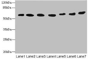 Western blot All lanes: ATL2 antibody at 1 μg/mL Lane 1: HepG2 whole cell lysate Lane 2: MCF-7 whole cell lysate Lane 3: HL60 whole cell lysate Lane 4: K562 whole cell lysate Lane 5: U251 whole cell lysate Lane 6: A549 whole cell lysate Lane 7: A431 whole cell lysate Secondary Goat polyclonal to rabbit IgG at 1/10000 dilution Predicted band size: 67, 47, 66, 65 kDa Observed band size: 67 kDa (ATL2 Antikörper  (AA 1-300))