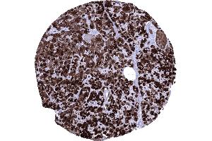 Normal pancreas with strong CELA3B positivity of acinar cells (Rekombinanter Elastase 3B Antikörper  (AA 82-238))