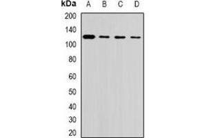Western blot analysis of USP26 expression in Hela (A), U937 (B), mouse testis (C), rat liver (D) whole cell lysates.