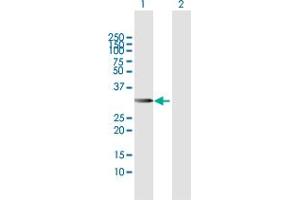 Western Blot analysis of CDCA8 expression in transfected 293T cell line by CDCA8 MaxPab polyclonal antibody. (CDCA8 Antikörper  (AA 1-280))