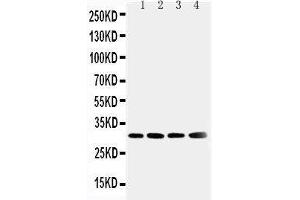 Anti-Superoxide Dismutase 3 antibody, Western blotting Lane 1: Human Placenta Tissue Lysate Lane 2: A549 Cell Lysate Lane 3: MM231 Cell Lysate Lane 4: MCF-7 Cell Lysate (SOD3 Antikörper  (N-Term))