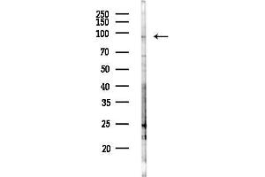 Western blot analysis of lysates from HepG2 cells(LPS,4h treatment), using NOP2 Antibody at 1/1000 dilution.