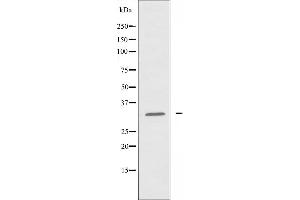 Western blot analysis of extracts from Jurkat cells, using ATF5 antibody. (ATF5 Antikörper  (N-Term))