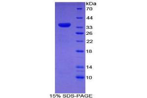 SDS-PAGE (SDS) image for Myosin ID (MYO1D) (AA 512-788) protein (His tag) (ABIN2121688) (Myosin ID Protein (MYO1D) (AA 512-788) (His tag))