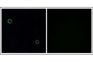 Immunofluorescence analysis of A549 cells, using CXCR4 Antibody. (CXCR4 Antikörper  (C-Term))