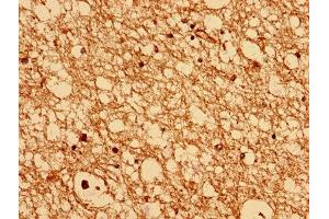 Immunohistochemistry analysis of human brain tissue using ABIN7147533 at dilution of 1:100 (CHMP6 Antikörper  (AA 2-201))